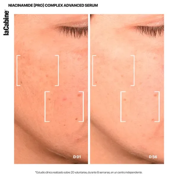 Discount 25% Niacinamide Complex Serums