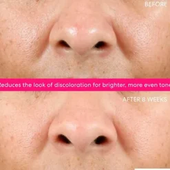 New Ageless Phyto-Aha Radiance Facial Peeling Hidratación