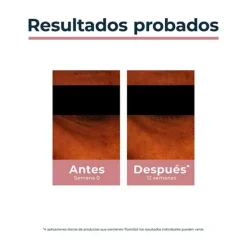 Anti-Pigment*EUCERIN Discount