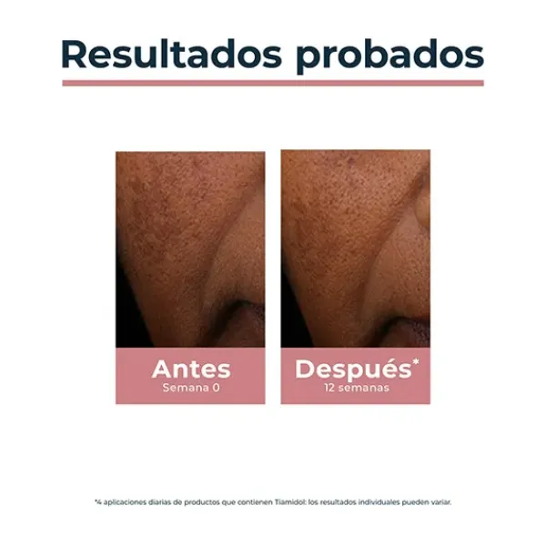 Anti-Pigment Spot Corrector*EUCERIN Sale