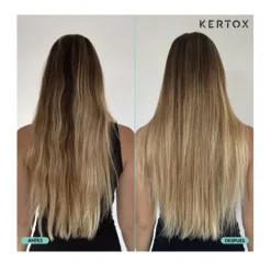 Clearance KERTOX Botox