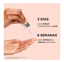 Hot Bye Bye Breakout Serums