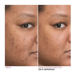 Bye Bye Dark Spots Niacinamide Serum Serums
