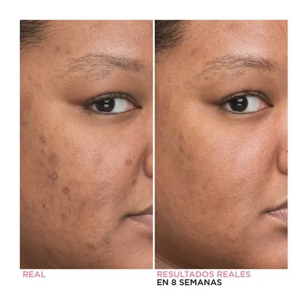 Bye Bye Dark Spots Niacinamide Serum Serums