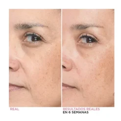 Sale Bye Bye Lines Hyaluronic Acid Serum Serums