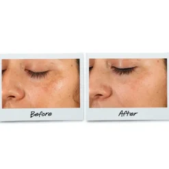 Online Clearly Corrective™ Dark Spot Solution Serums