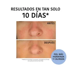 Clearance Discos Hidratantes De Arándanos Limpieza