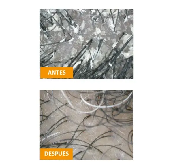 New AS I AM Dry & Itchy