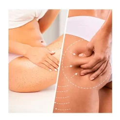 Exfoliante Niacin Cellulite*BIOVENE Discount