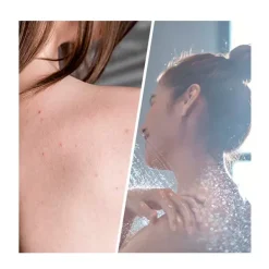 Clearance Exfoliante Salicylic Blemish Limpieza