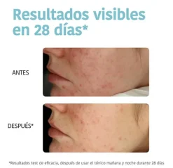 Exfoliating Anti-Blemish*IROHA NATURE Clearance