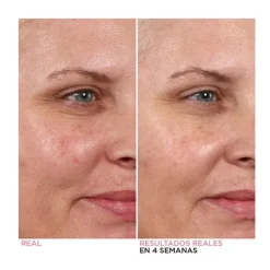 Online Hello Results Baby-Smooth Glycolic Peel + Caring Oil Serums