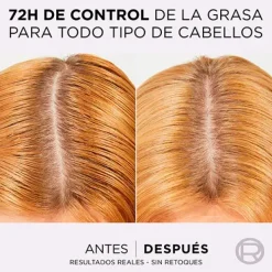 Hialurónico Pure*ELVIVE Best