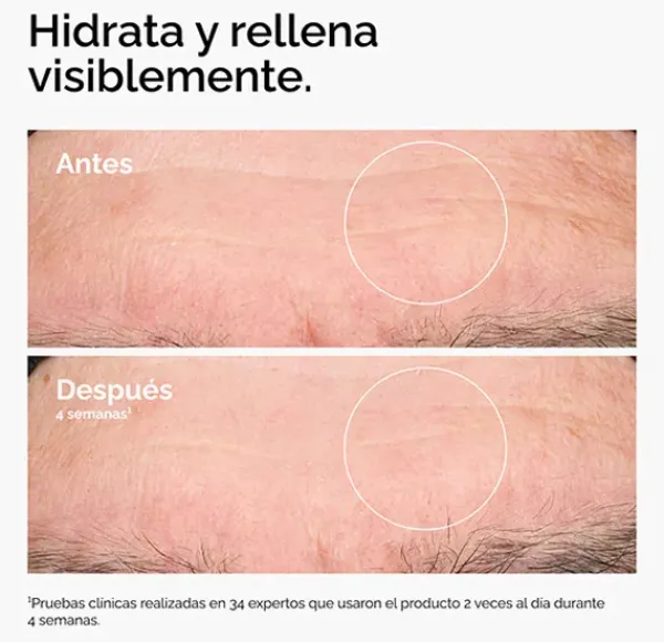 Discount Hyaluronic Acid 2% + B5 Serums