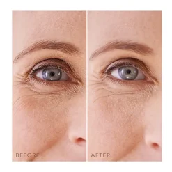 Iris Under-Eye-Patches*FOREO Discount