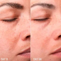 FRESHLY COSMETICS Lotus Radiance Dark Spot Treatment