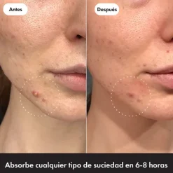 Clearance HERO COSMETICS Mighty Patch The Original