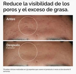 Niacinamide 10% + Zinc 1%*THE ORDINARY Sale