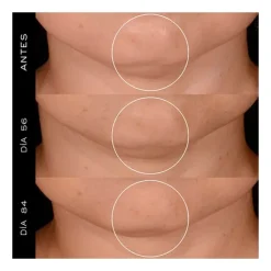 Rénergie H.P.N. 300-Peptide Cream*LANCOME Sale