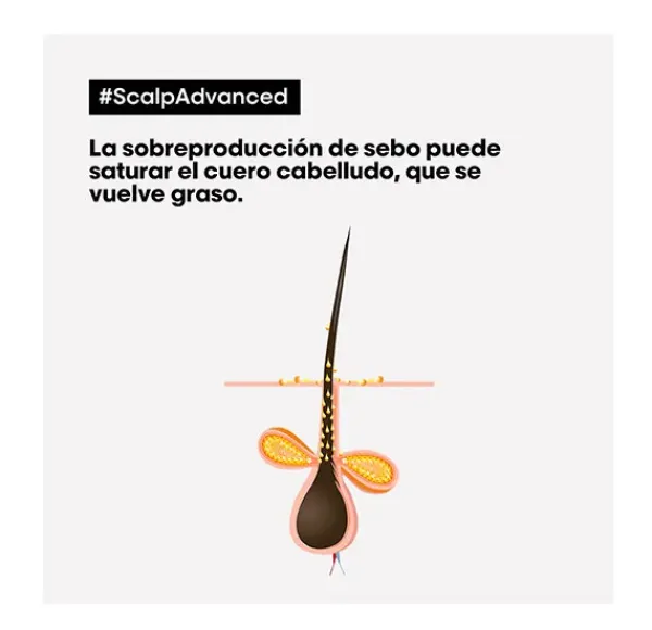 L'OREAL PROFESSIONNEL Scalp Advanced