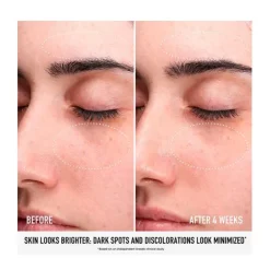 Discount Skin Rescue Pure Glow Serums