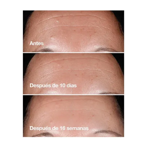 Discount Smart Clinical Repair™ Serum Serums