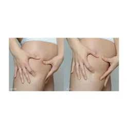 FOREO Supercharged Firming Body Serum