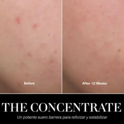 The Concentrate*LA MER