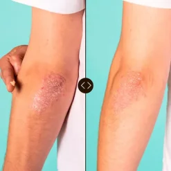 Vegan Hero All-Porpose Balm Rostro